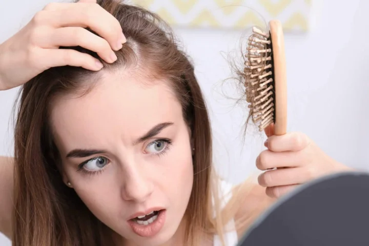 Chute de cheveux