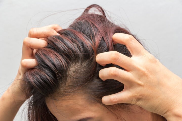 Cuir chevelu sensible ou irrité causes et solutions apaisantes
